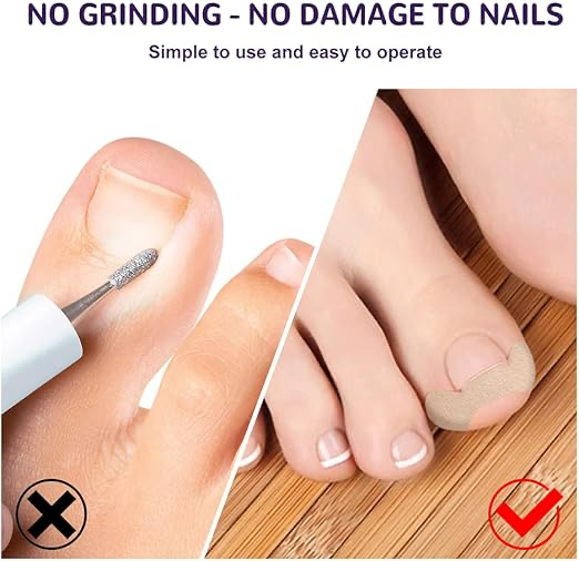 Ayak Tırnağı Düzeltme Bandı 50 Adet Şık Tasarımıyla Benzersiz Kullanım Deneyimi Hayatınızı Kolaylaştıracak Ürünler