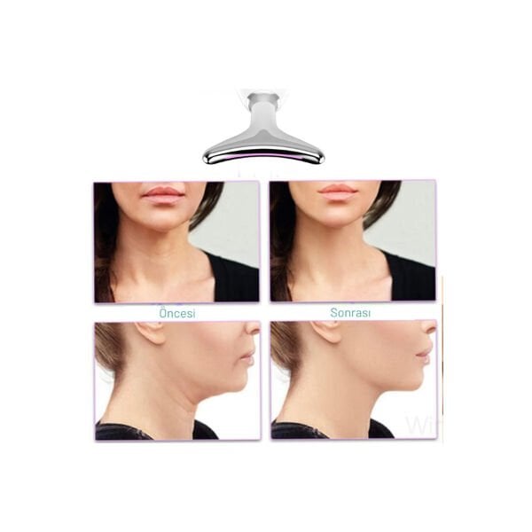 Kırışıklık Giderici Masaj Cihazı Şık Tasarımlı Fonksiyonel Ürün